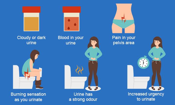 Guide for female cyclists: dealing with saddle soreness image 28